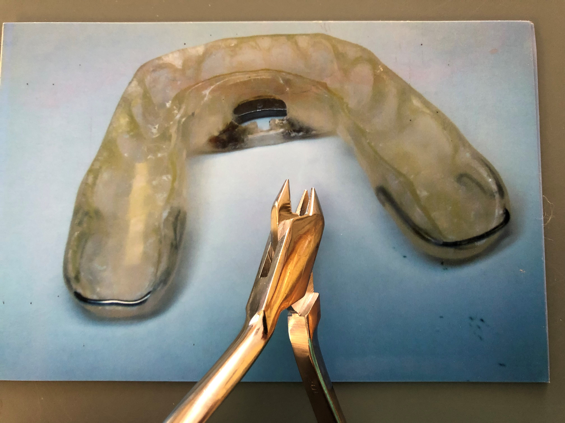 Figure 1: Appliance made by Thomas Schell, DMD