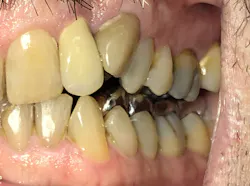 Figure 2: Left lateral view Figure 2: Left lateral view