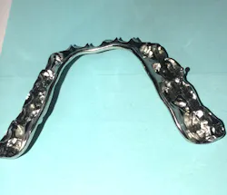 Figure 3: Metal occlusal appliance Figure 3: Metal occlusal appliance