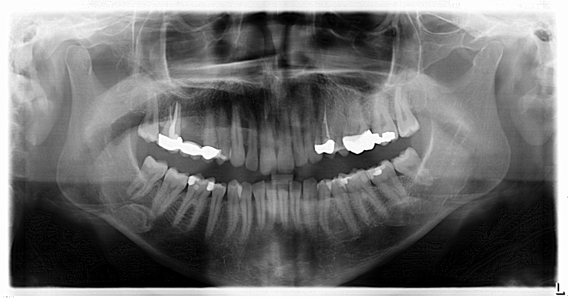 19 Jun27 B Cpath41 Dx T