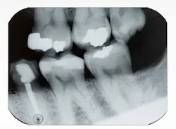 X Ray 5dcd865fabccd X Ray 5dcd865fabccd