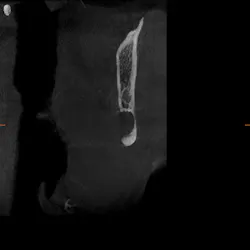 Figure 2: 3-D cross-sectional Figure 2: 3-D cross-sectional