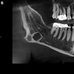 Figure 3: 3-D longitudinal Figure 3: 3-D longitudinal