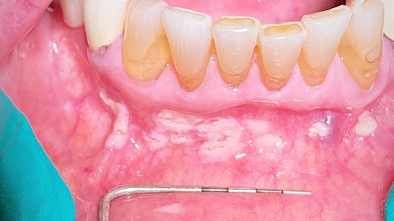 Figure1 5f85d692629f4