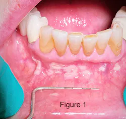 Figure 1: Case presentation Figure 1: Case presentation