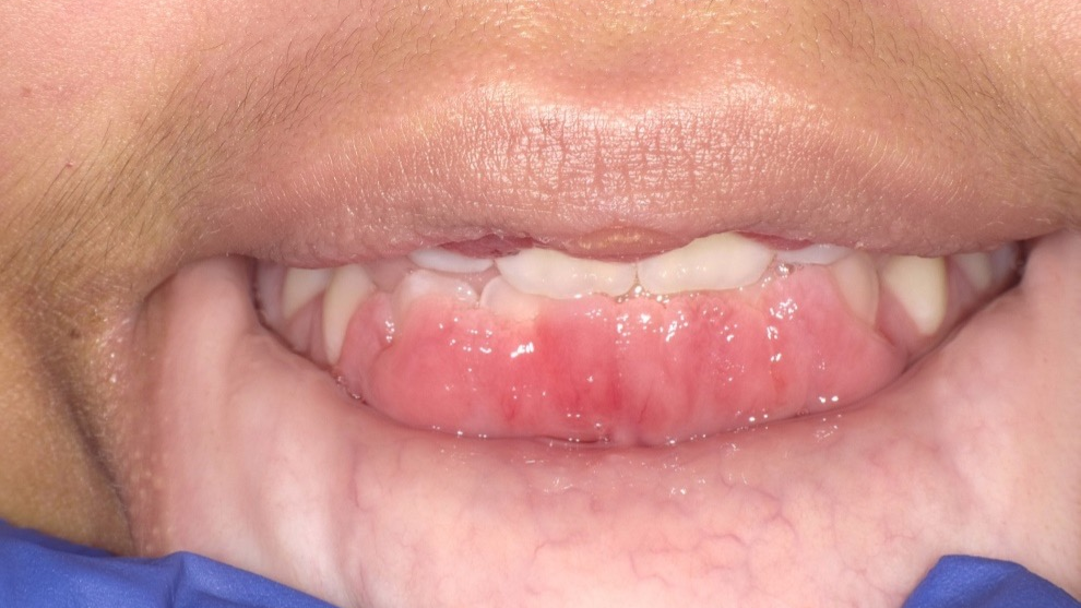 Figure 1: Case presentation