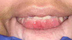 Figure 1: Case presentation Figure 1: Case presentation