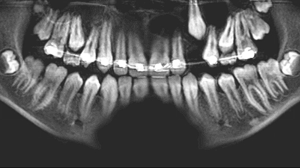 Pan Patient2 63ee6519b40fa