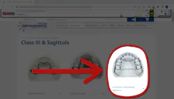 The LVI Anterior Remodeling Appliance, or ARA, is seen on the website of its manufacturer, Five Star Orthodontic, as shown on Internet Archive’s Wayback Machine. Five Star Orthodontic no longer features the device on its website and declined to comment on the product. The LVI Anterior Remodeling Appliance, or ARA, is seen on the website of its manufacturer, Five Star Orthodontic, as shown on Internet Archive’s Wayback Machine. Five Star Orthodontic no longer features the device on its website and declined to comment on the product.