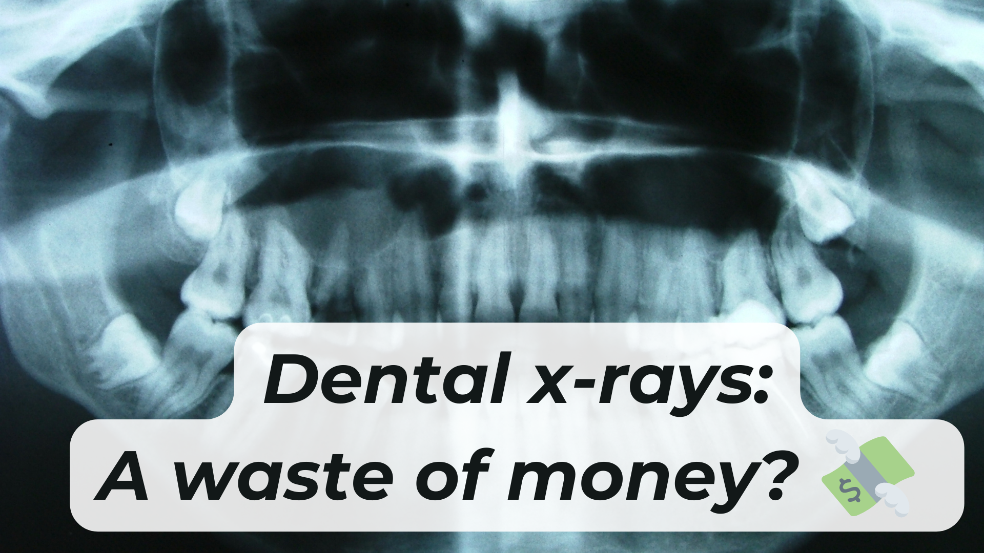 the cost of dental x-rays