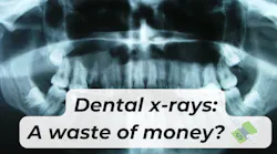 the cost of dental x-rays the cost of dental x-rays