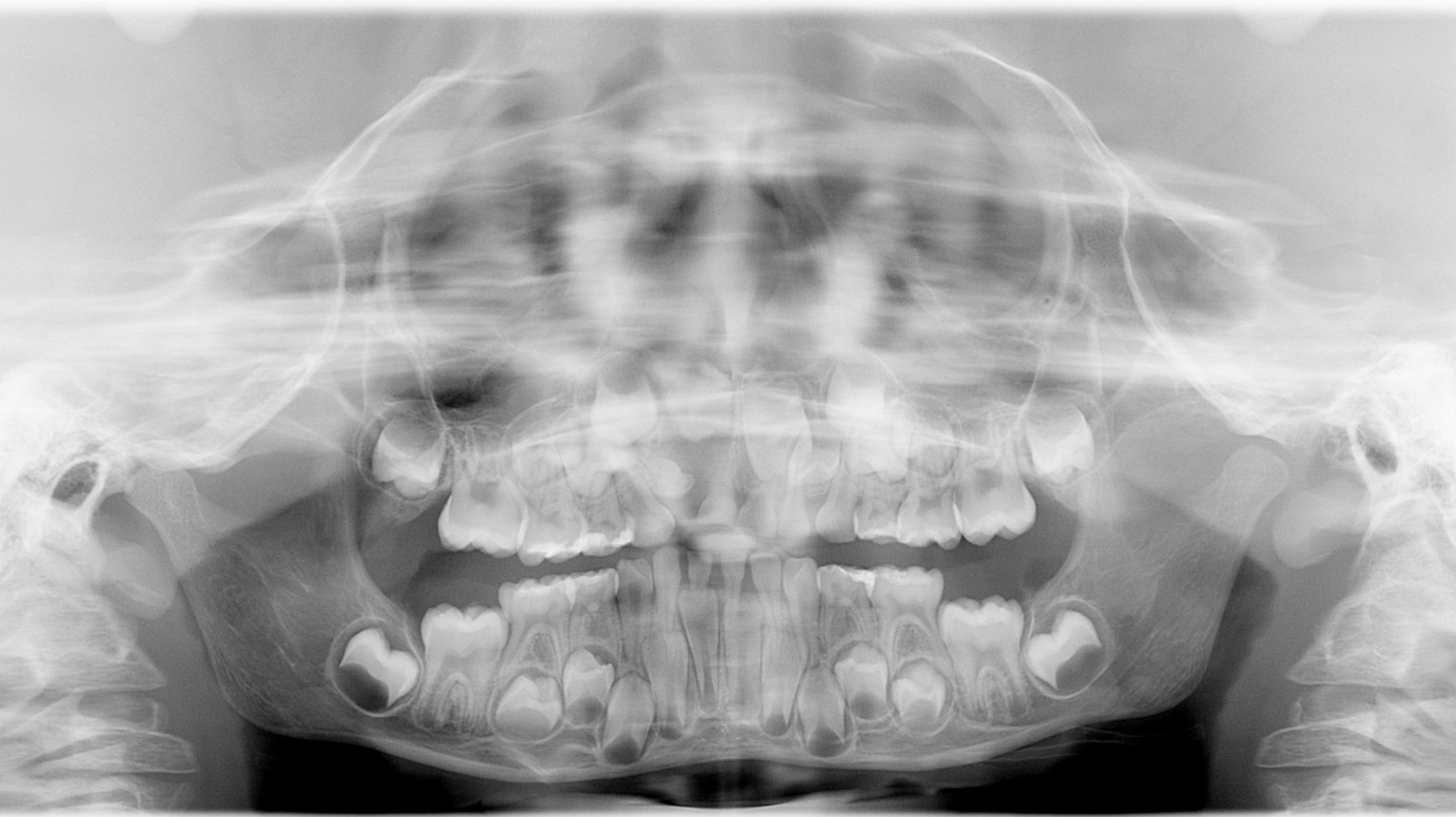 Fig1 Pan 64b054d289530