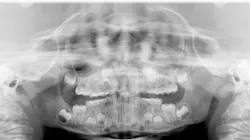 Fig1 Pan 64b054d289530 Fig1 Pan 64b054d289530