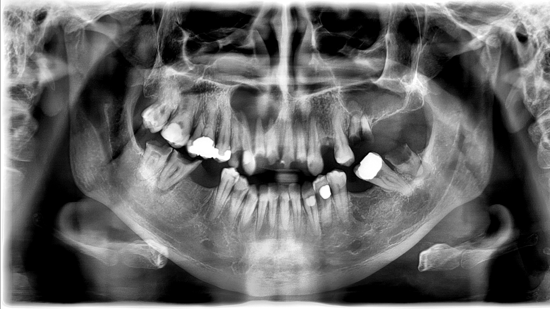 Shumway Patient Shaw 653fdb475d69a
