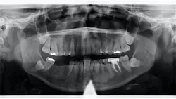 65b81e0cdcb06f001e4ce96b T 65b81e0cdcb06f001e4ce96b T