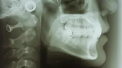 oral-systemic-health oral-systemic-health