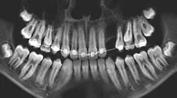 oral-pathology oral-pathology