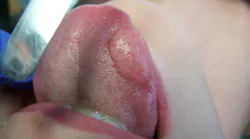 oral-pathology oral-pathology