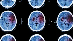 6679cdfc5faafef12bb5fc41 Dreamstime Xxl 54153709 6679cdfc5faafef12bb5fc41 Dreamstime Xxl 54153709