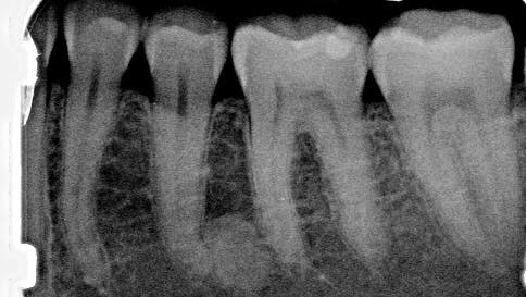 Pathology case: Differentials that may cross over