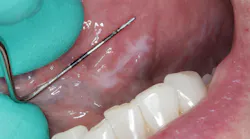 oral pathology reference oral pathology reference