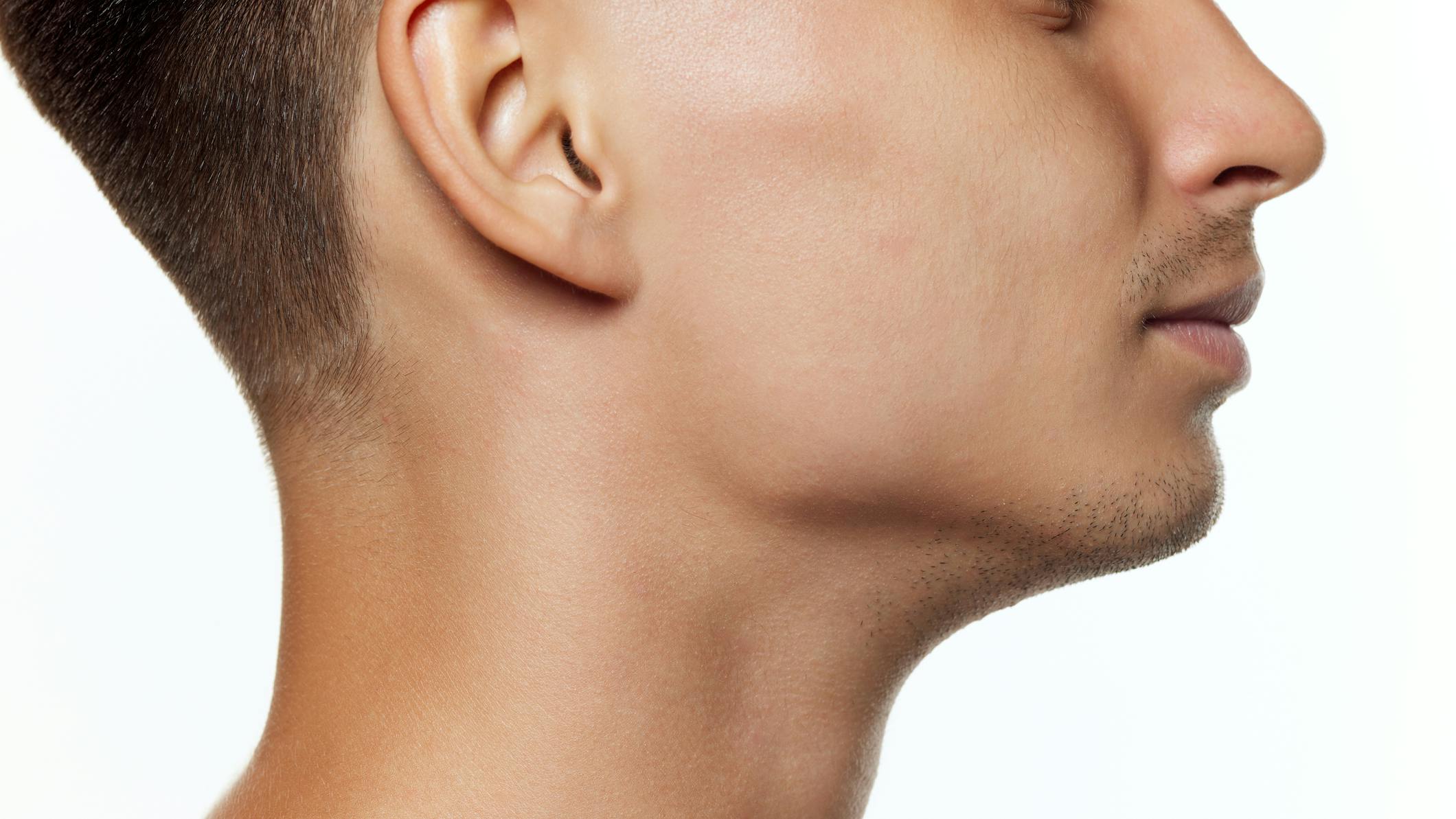 66ccb7221e4f6478ac7d9e34 Strong Jawline