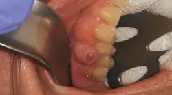 oral pathology oral pathology