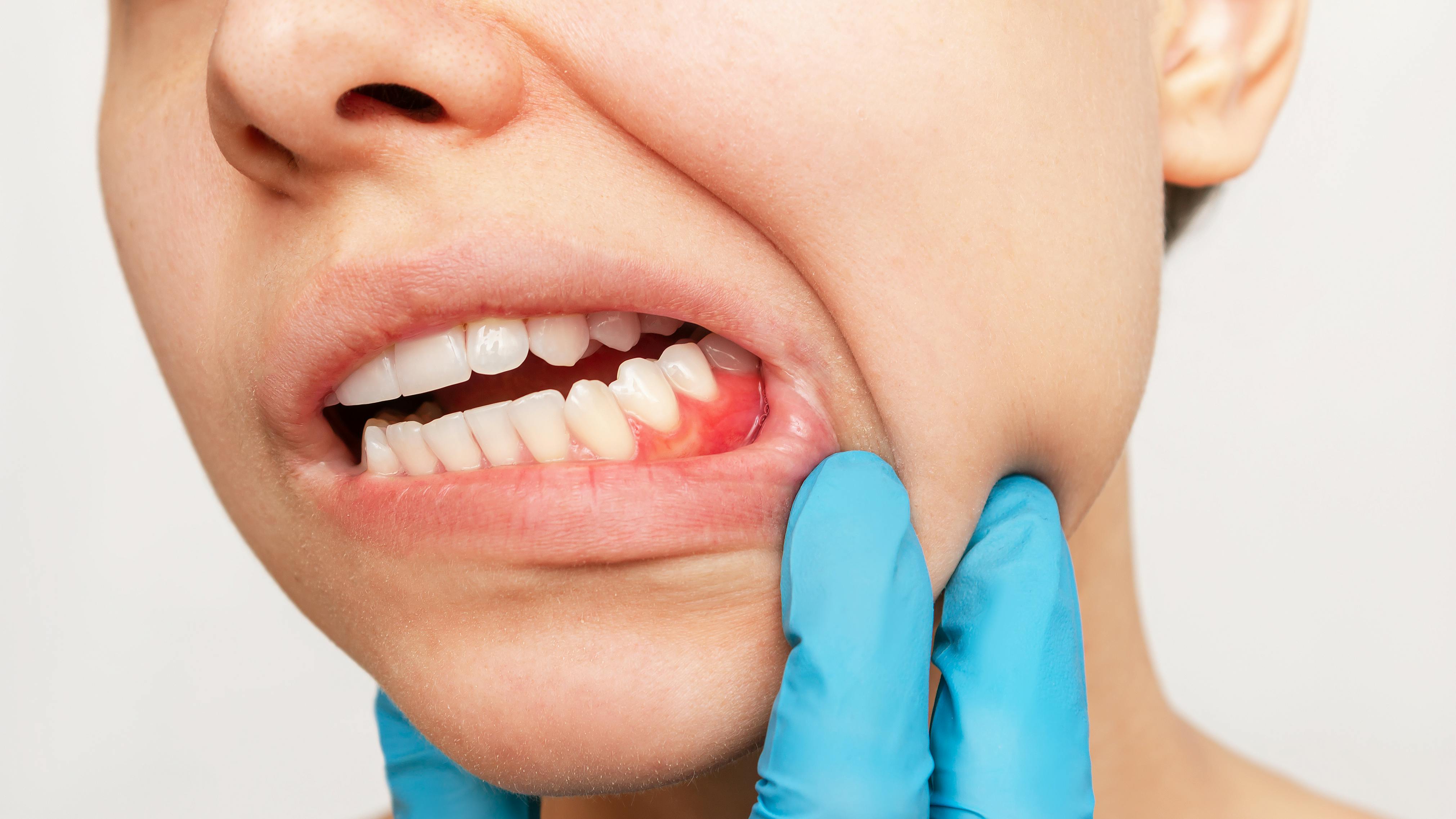 670e8f5fc6e2484dd2d8ed49 Gettyimages1377943103