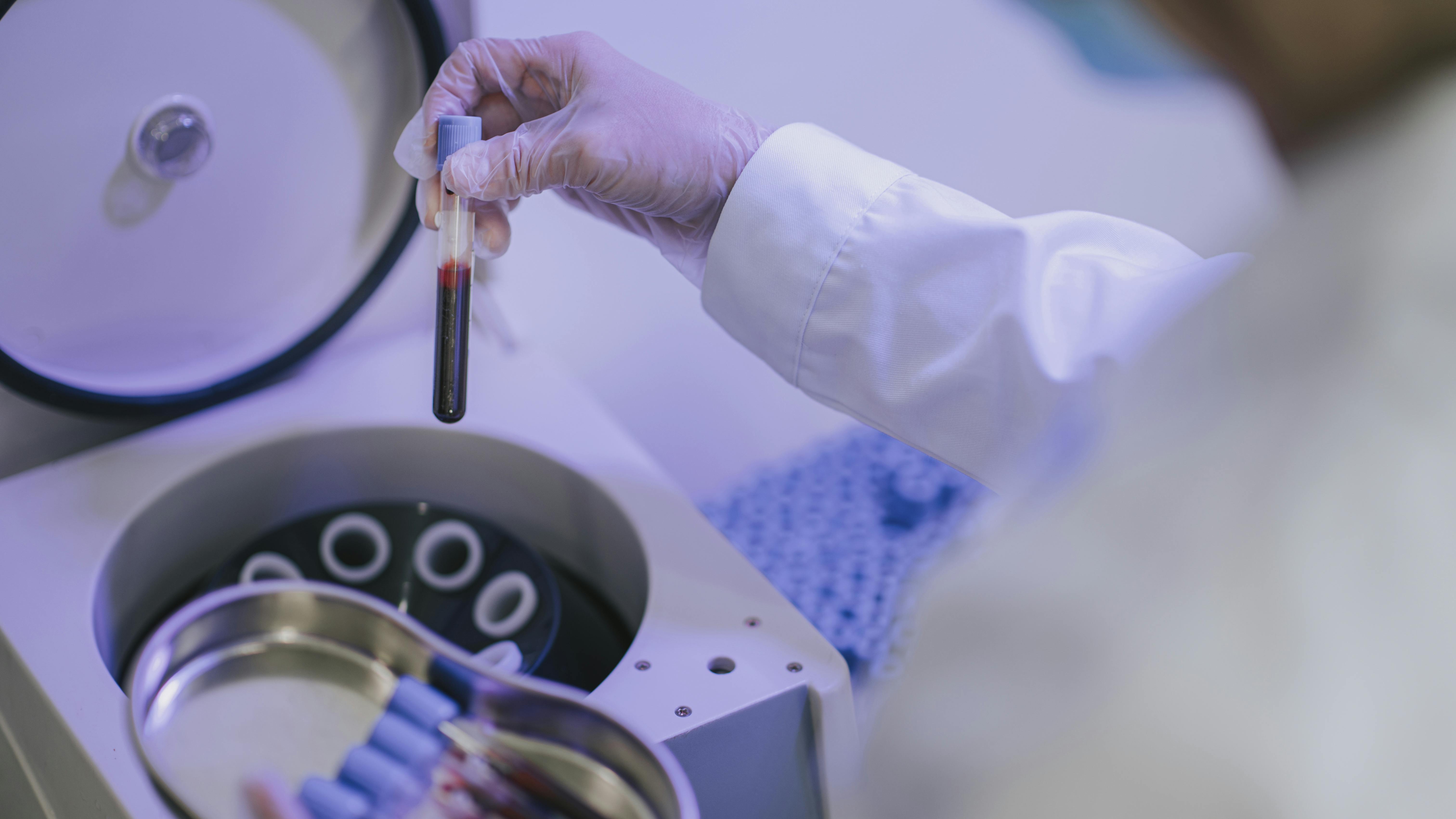 Platelet-rich fibrin (PRF) in dental surgery