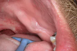 oral pathology oral pathology