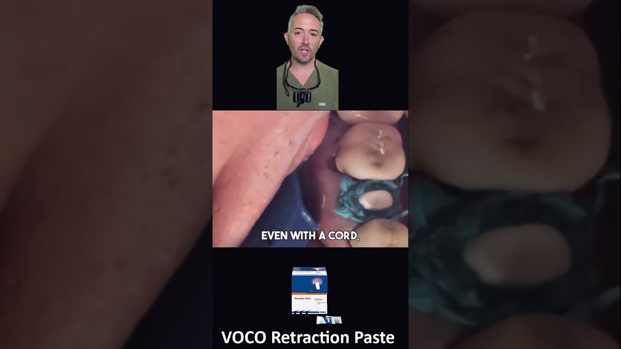 How to end retraction cord hassles