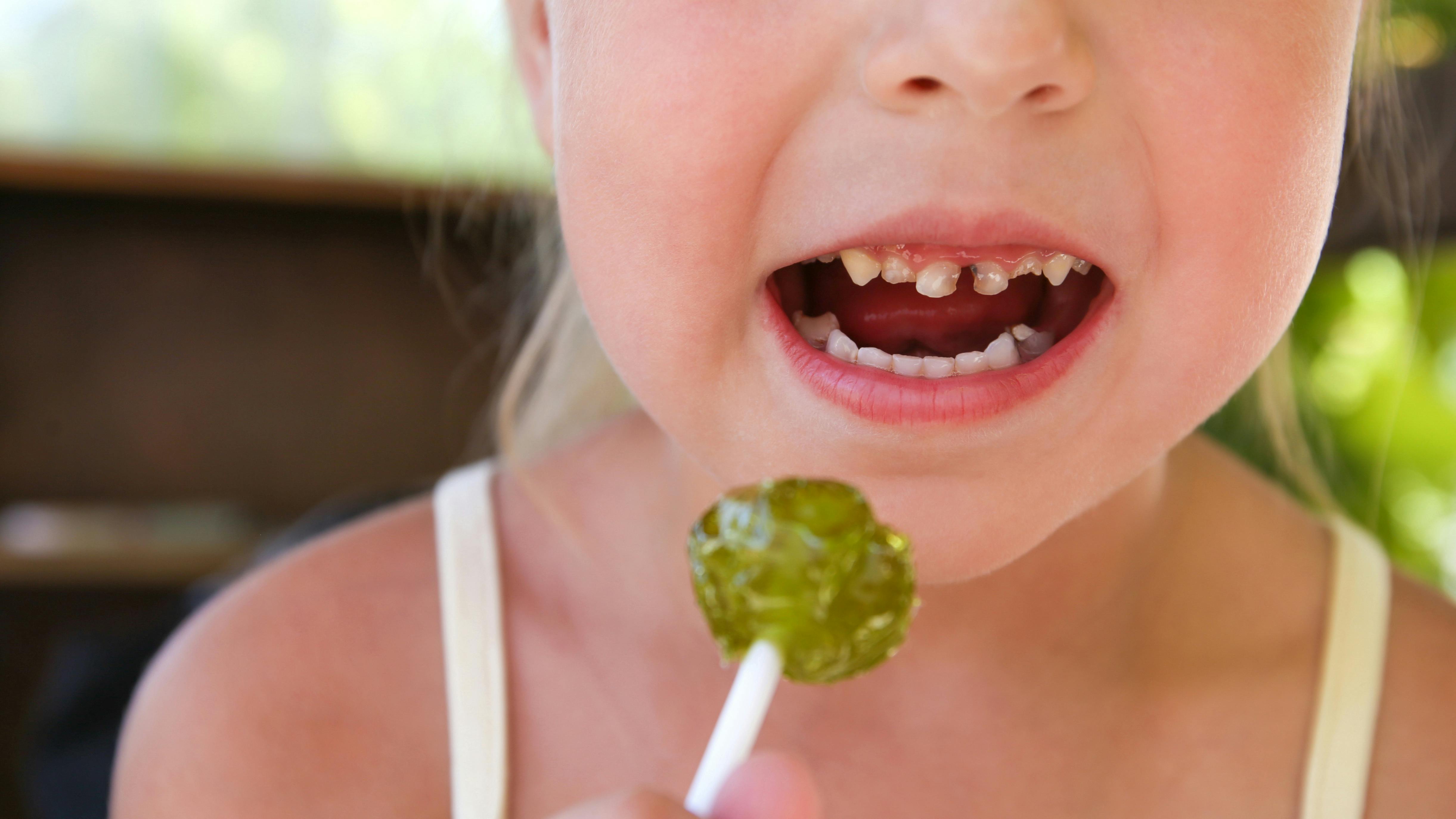 Child with poor oral health