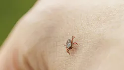 69caae0e8b09b17dc8da7655 Gettyimages2237933679 69caae0e8b09b17dc8da7655 Gettyimages2237933679