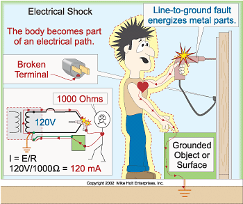electrical shock closely monity