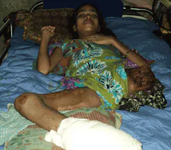 Ehstoday Com Sites Ehstoday com Files Uploads 2013 10 2 Bangladesh Rebek Ehstoday Com Sites Ehstoday com Files Uploads 2013 10 2 Bangladesh Rebek