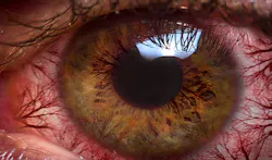 Thinkstock Thinkstock