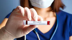 Coronavirus 2 5e878e9e65780 Coronavirus 2 5e878e9e65780