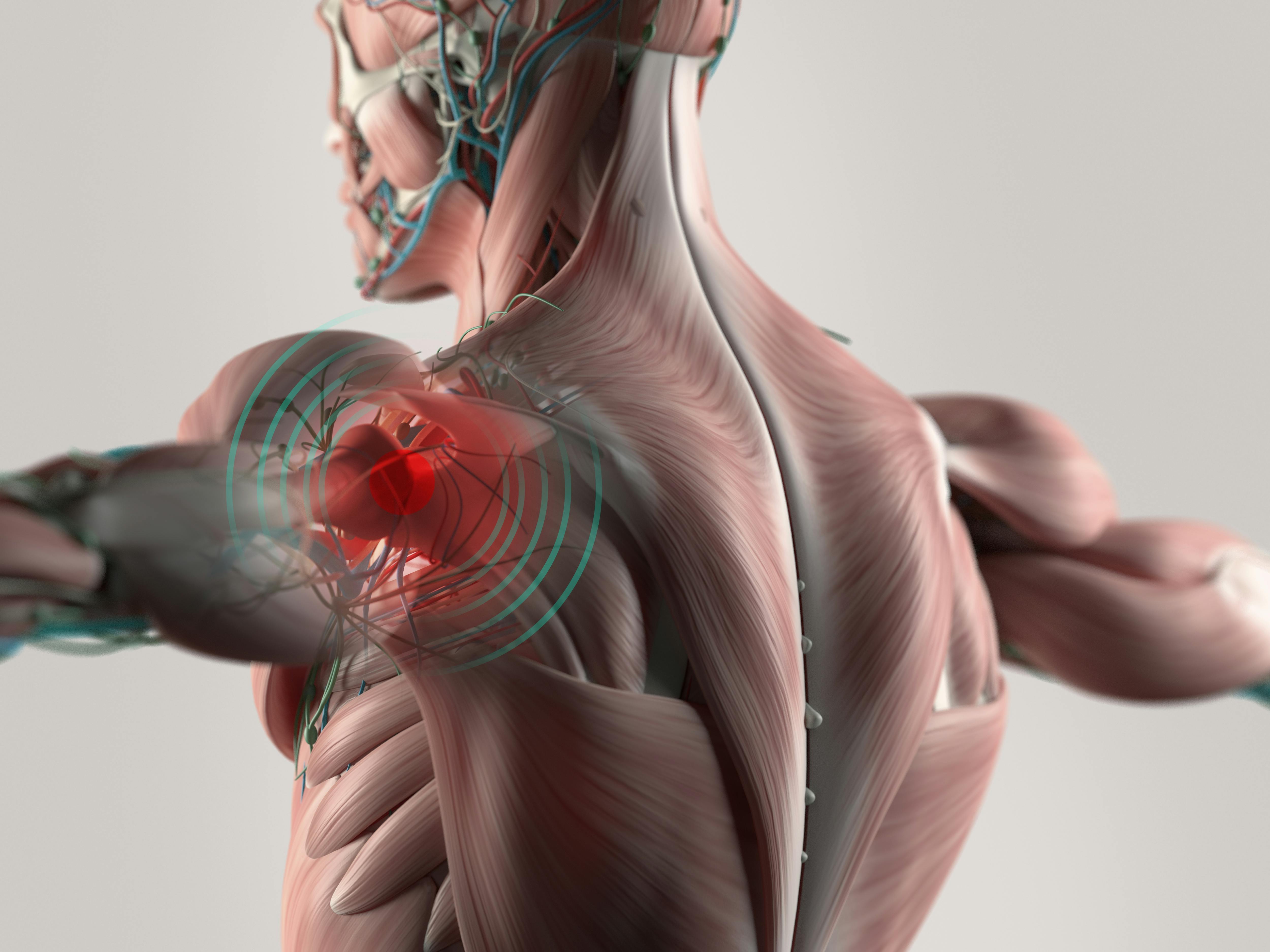 NSC Grants Produce Innovative Solutions to Prevent MSD Injuries