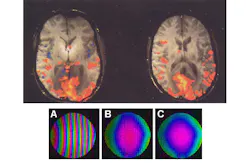 Electronicdesign Com Sites Electronicdesign com Files Uploads 2014 03 105551 Fig1 Mri Electronicdesign Com Sites Electronicdesign com Files Uploads 2014 03 105551 Fig1 Mri