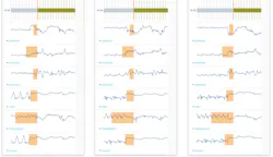 Www Electronicdesign Com Sites Electronicdesign com Files Falkonry Fig1 Www Electronicdesign Com Sites Electronicdesign com Files Falkonry Fig1