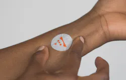 No larger than a postage stamp and as thin as a human hair these devices consist of an antenna and thinned nearfield communication chip mounted onto a stretchable adhesive Image courtesy of MC10 No larger than a postage stamp and as thin as a human hair these devices consist of an antenna and thinned nearfield communication chip mounted onto a stretchable adhesive Image courtesy of MC10