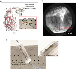 Electronicdesign Com Sites Electronicdesign com Files Pet Pacemaker Harvesting Fig1 Web Electronicdesign Com Sites Electronicdesign com Files Pet Pacemaker Harvesting Fig1 Web