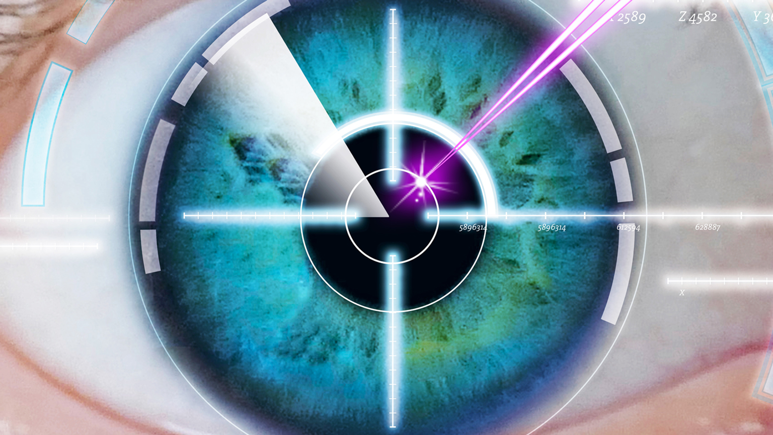 Eye Surgery Shweiber Promo 5e46b727bf23c