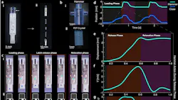 Promoed Interest Sparker Fig3 5eda5bf784077 Promoed Interest Sparker Fig3 5eda5bf784077
