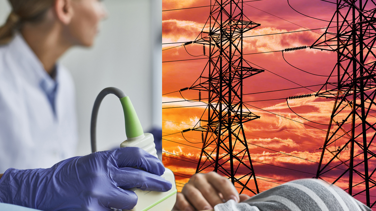 Ultrasound Promo 60ae6e0595a9d