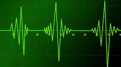 dreamstime_andreavolpicelli_43274 dreamstime_andreavolpicelli_43274