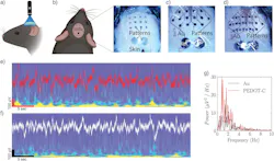 In vivo photo-patterns (e-tattoo) for EEG In vivo photo-patterns (e-tattoo) for EEG