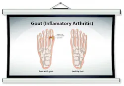 Fleetowner Com Sites Fleetowner com Files Uploads 2017 01 18 Gout2 Fleetowner Com Sites Fleetowner com Files Uploads 2017 01 18 Gout2