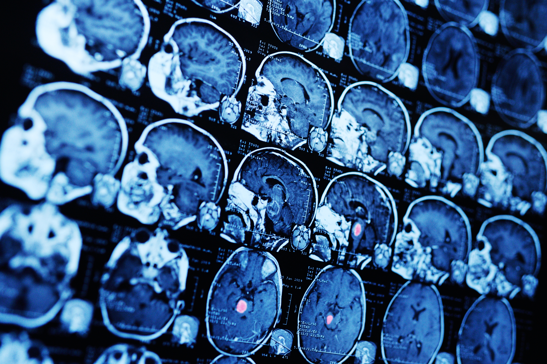 Bigstock Mri Magnetic Resonance Image S 284633278 5f3ac421d6d49