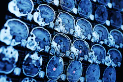 Bigstock Mri Magnetic Resonance Image S 284633278 5f3ac421d6d49 Bigstock Mri Magnetic Resonance Image S 284633278 5f3ac421d6d49